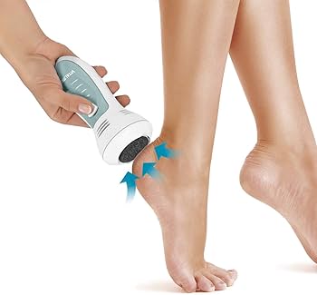 VITALmaxx Pedi Power – Electric Callus Remover with Vacuum